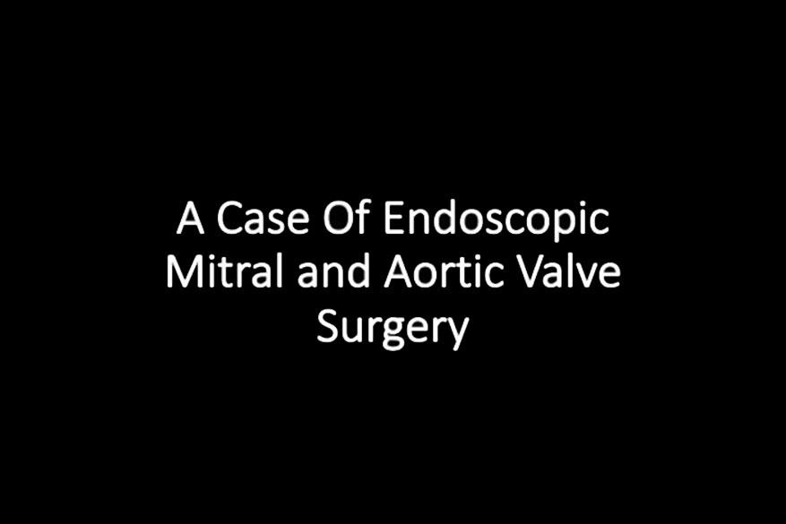 Totally Endoscopic Mitral and Aortic Valve Surgery